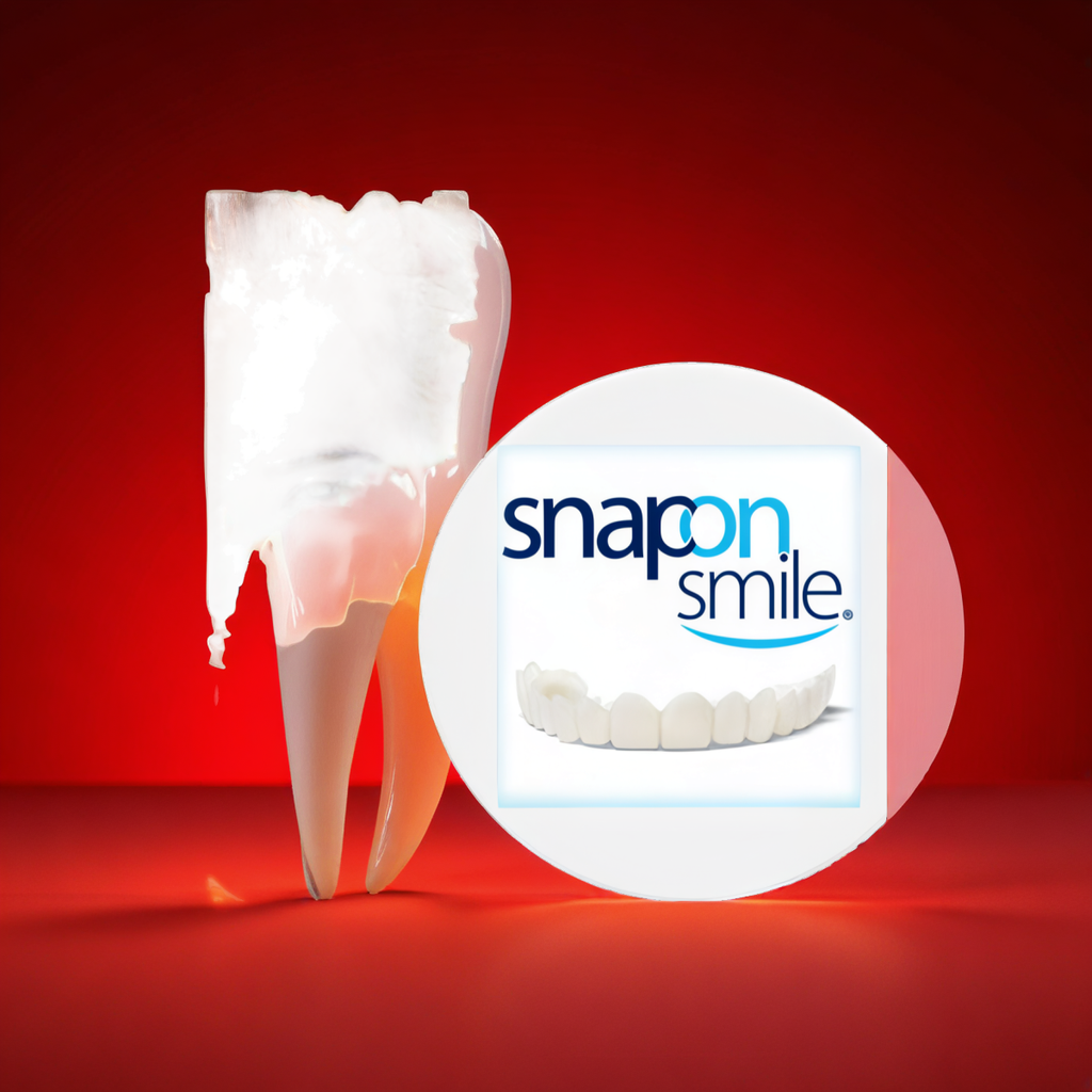 Snap-On Smile