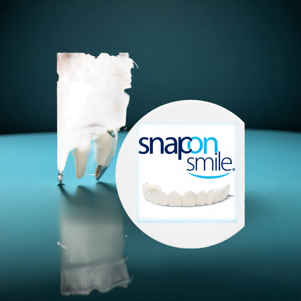 Snap-On Smile
